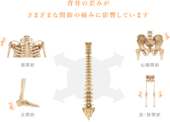 背骨の歪みがさまざまな関節への痛みに影響します