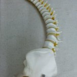 ぎっくり腰　　デスクワーク過多の丸まり姿勢に頻発する疾患　せぼね研究室　