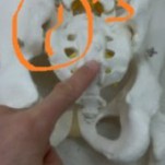 （ゆがみを改善する方法の動画あり）「仙腸関節の歪みかどうかをはっきりさせたい。」　　歪みを確定させる7つのチェック法＆超簡単　自分で治す方法　　　名古屋　整体　仙腸関節　　　せぼね研究室