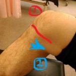 症例報告　　長年の膝痛　3週間で改善　　　　名古屋　　整体　　膝の痛み　　