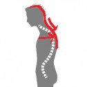 慢性頭痛の原因は背中の緊張。　名古屋　　整体　　背骨矯正　